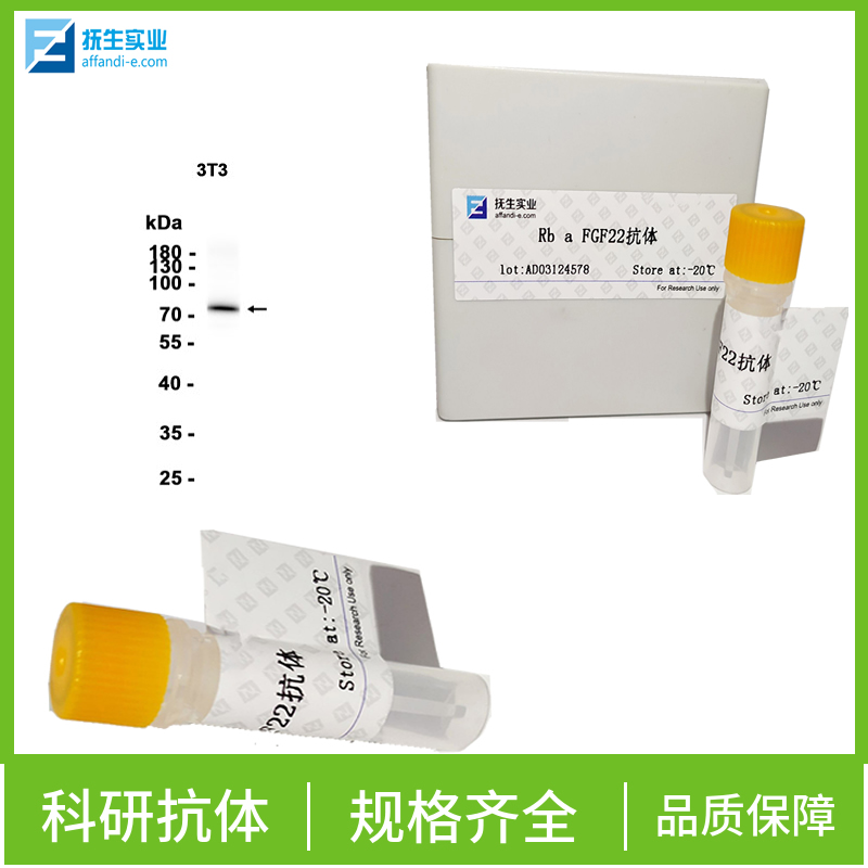 淋巴管内皮细胞和血管内皮细胞受体1抗体