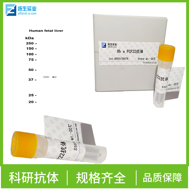 磷酸化p38MAPK抗体