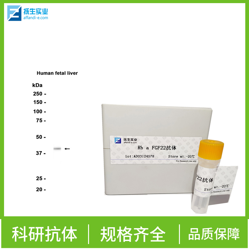 过氧化酶活化增生受体γ抗体