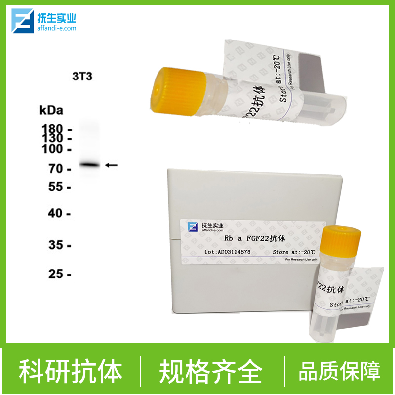 红细胞生成素抗体