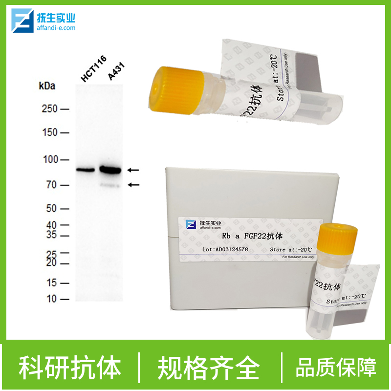 红细胞生成素受体抗体