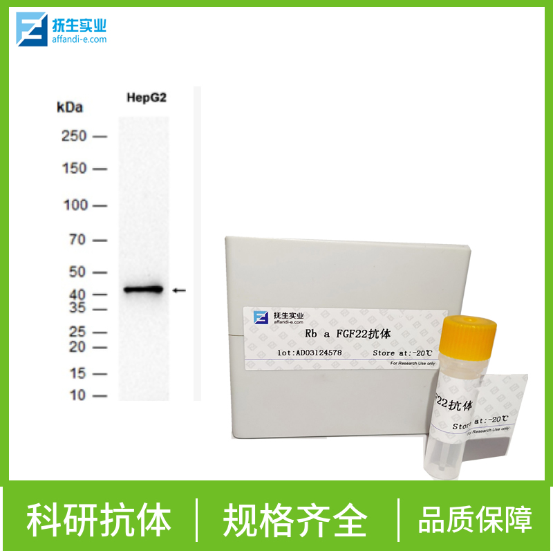 环腺苷酸应答元件结合蛋白5抗体