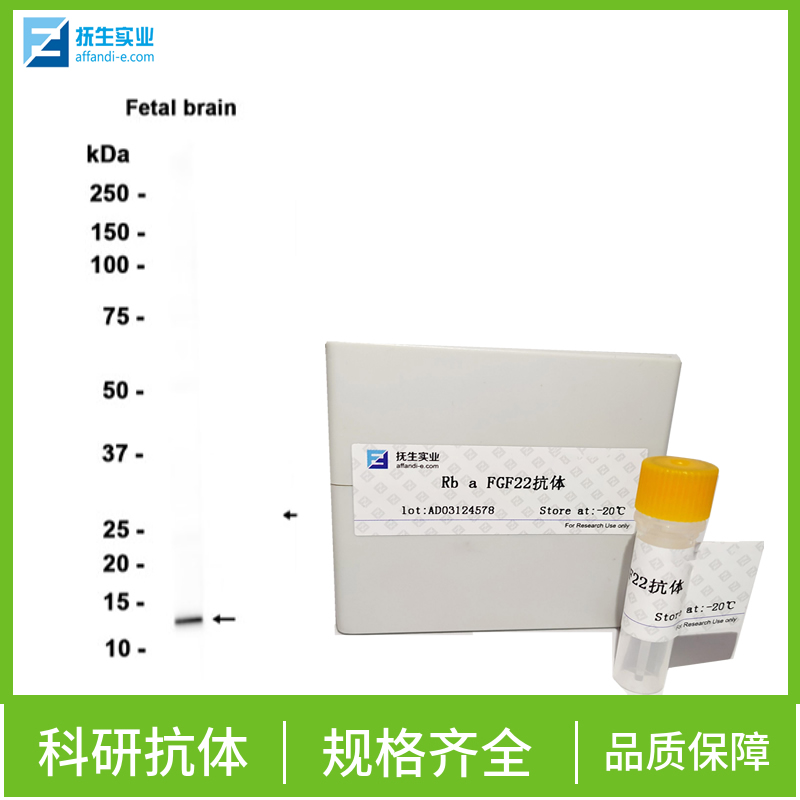 程序性死亡配体1（CD274）抗体