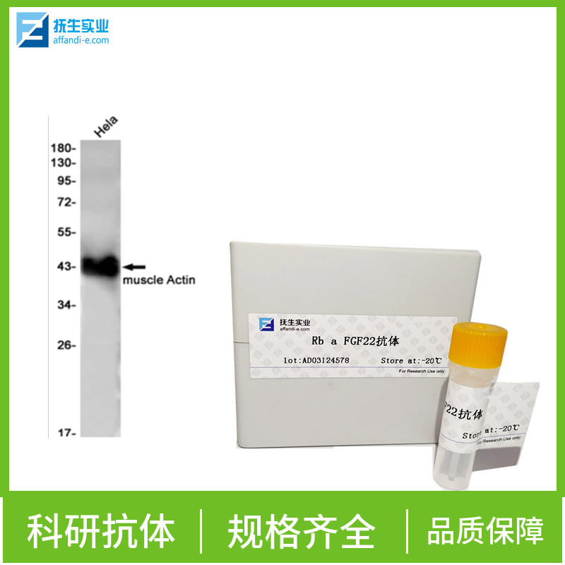 蛋白激酶AKT1,2,3抗体