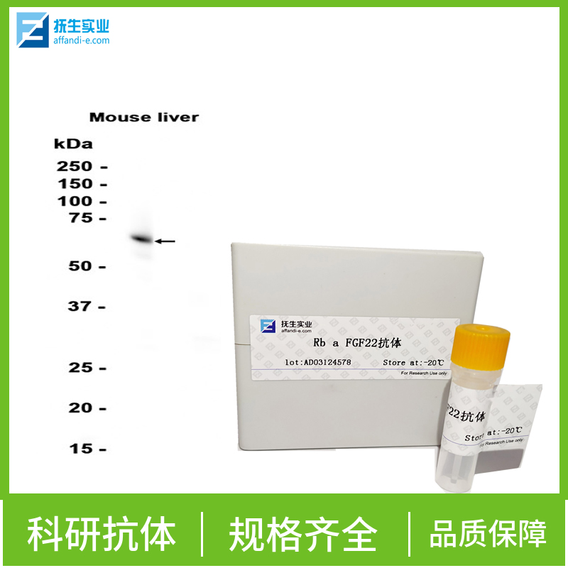 骨形态形成蛋白拮抗蛋白抗体