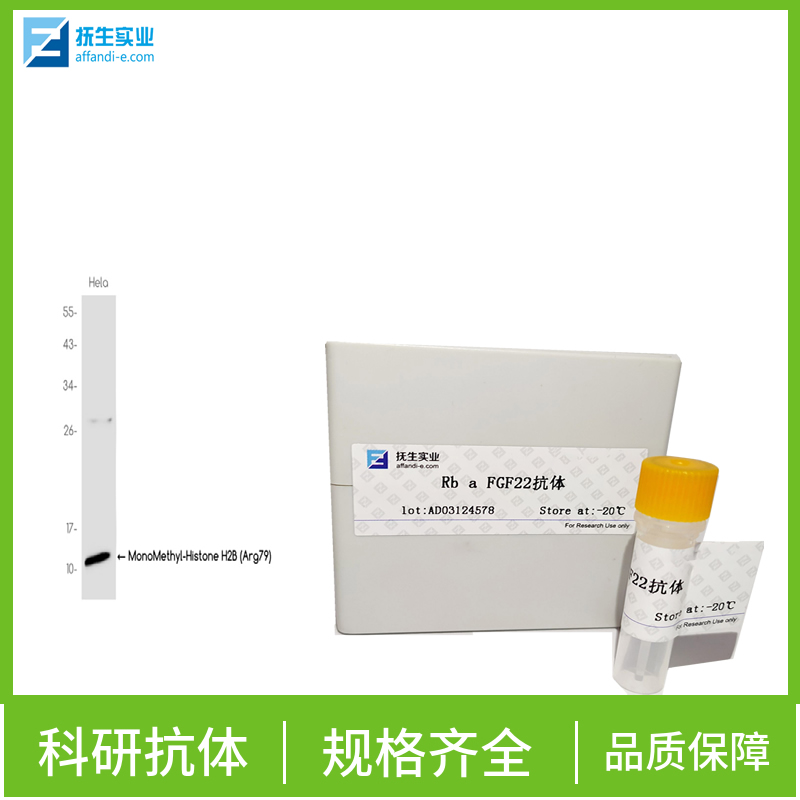 核纤层蛋白B(细胞核膜标志物)抗体