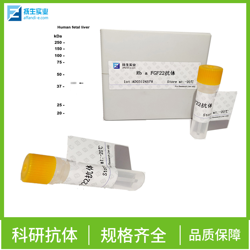 促卵泡刺激素抗体