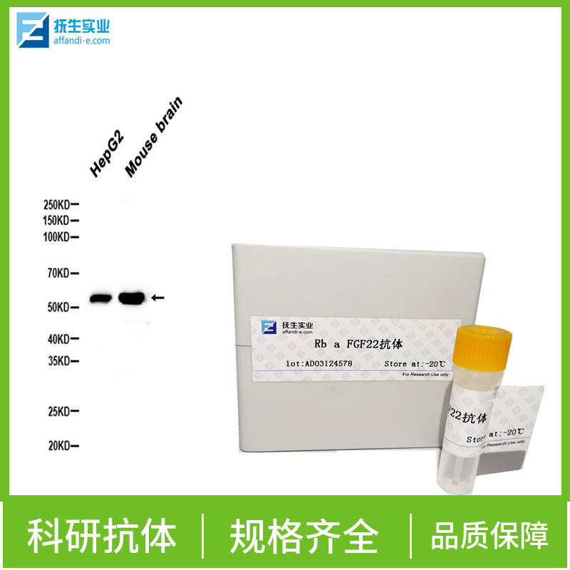 促性腺激素释放激素受体抗体