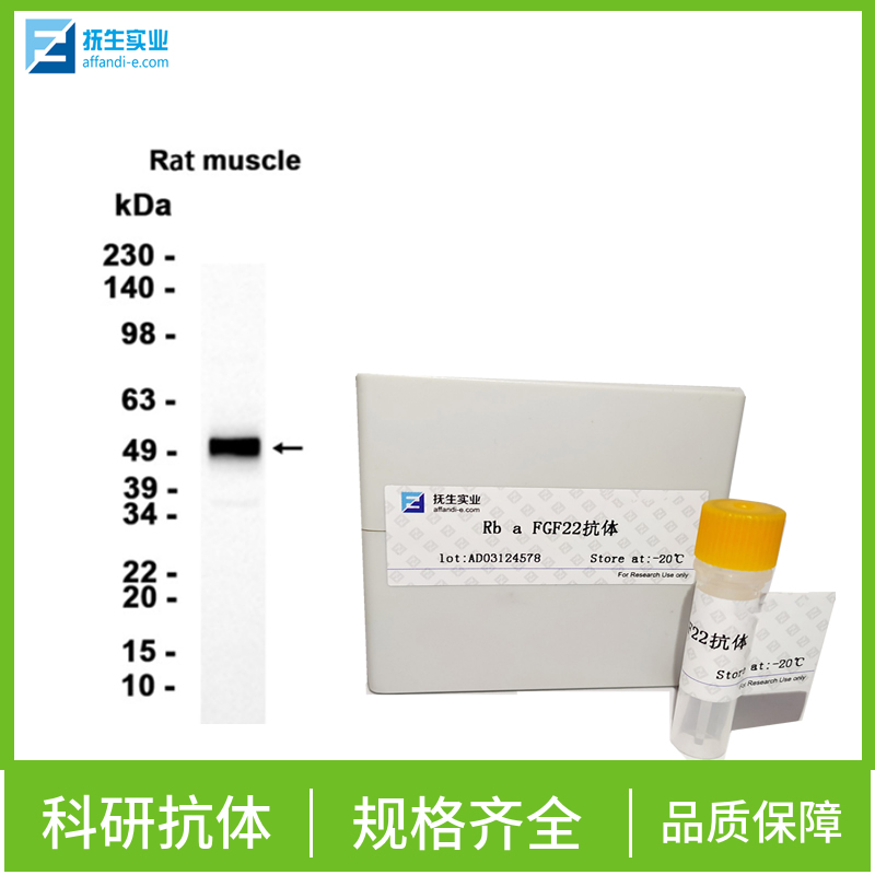单纯疱疹病毒1型转录调节因子ICP22抗体