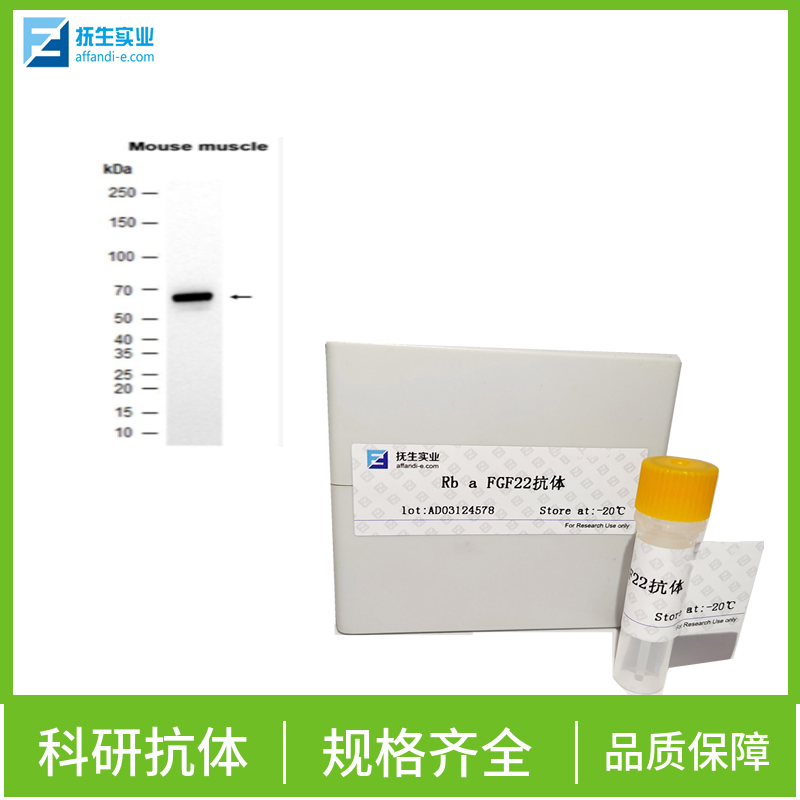 单纯疱疹病毒糖蛋白D抗体