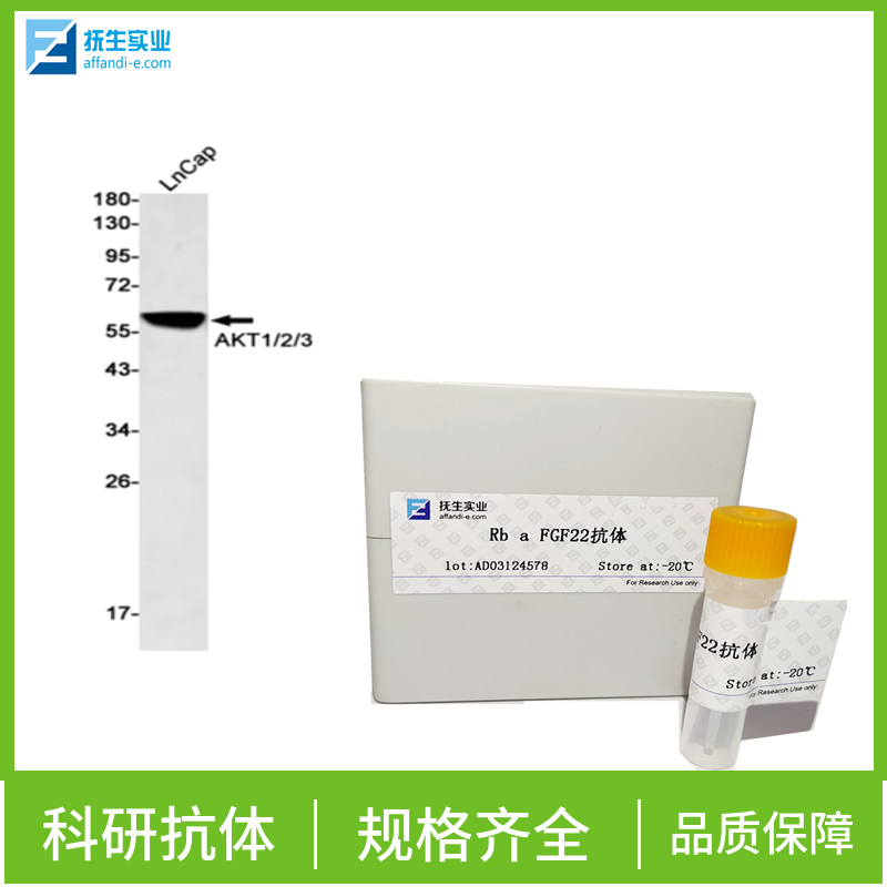 补体应答基因32抗体