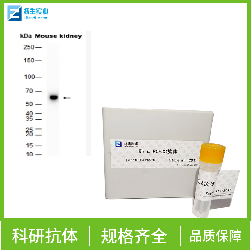 Strep-Tag II（标签）单克隆抗