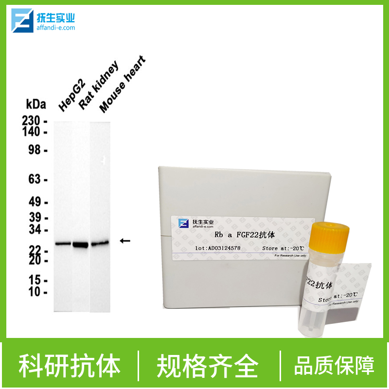 Wnt蛋白家族7B抗体