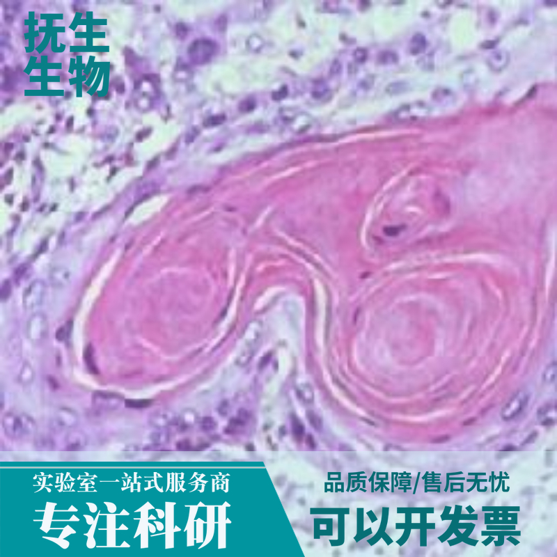 人单核白血病细胞带绿色荧光；THP-1/GFP