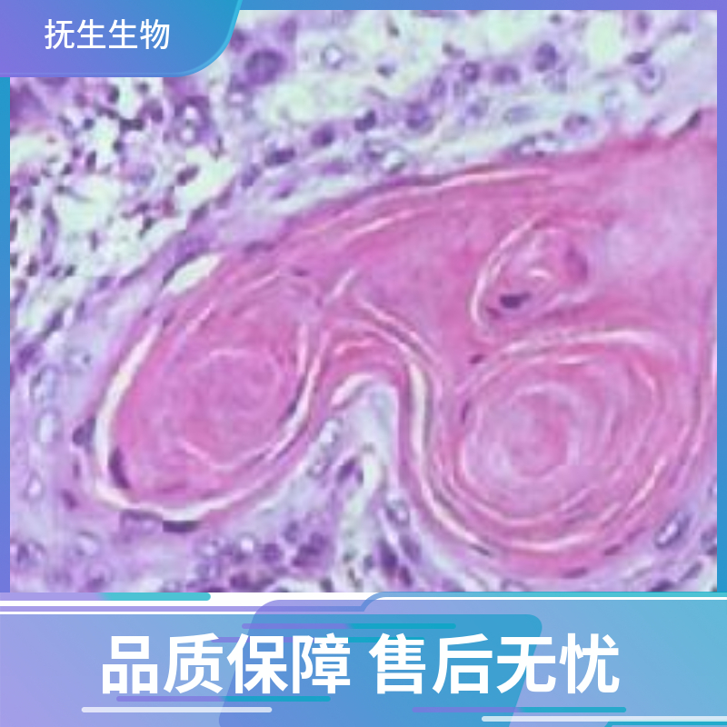 人膀胱癌细胞带荧光素酶；5637/LUC (STR)