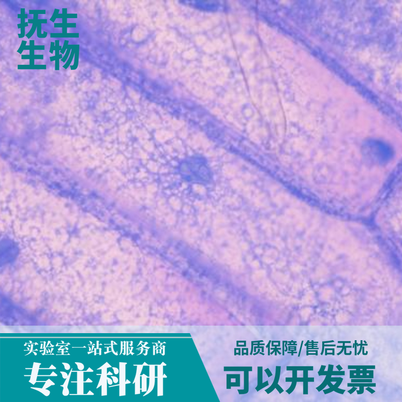 人Burkkit淋巴瘤细胞带荧光素酶；Daudi/LUC (STR)