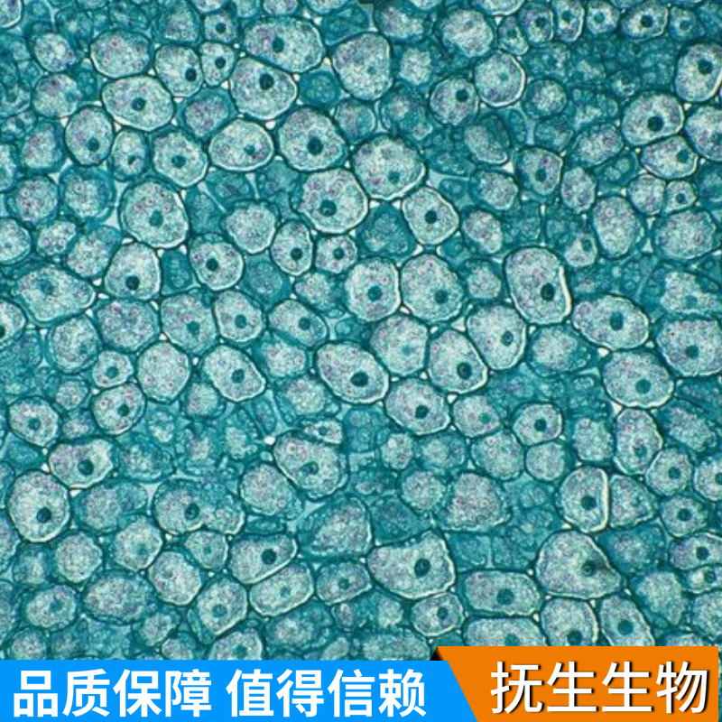 人骨髓增生异常综合征细胞株；MUTZ-1 (STR)