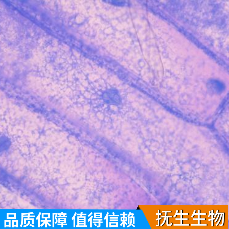 人免疫球蛋白lambda骨髓瘤细胞带荧光素酶；MM.1S/LUC (STR)