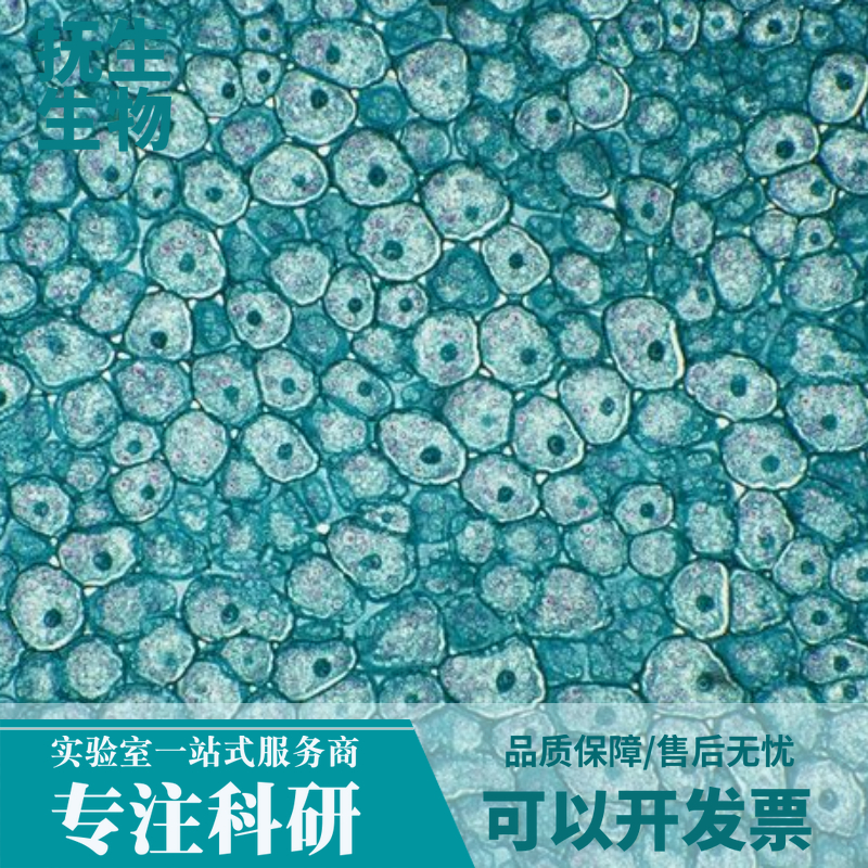 人B细胞淋巴瘤细胞；SC1