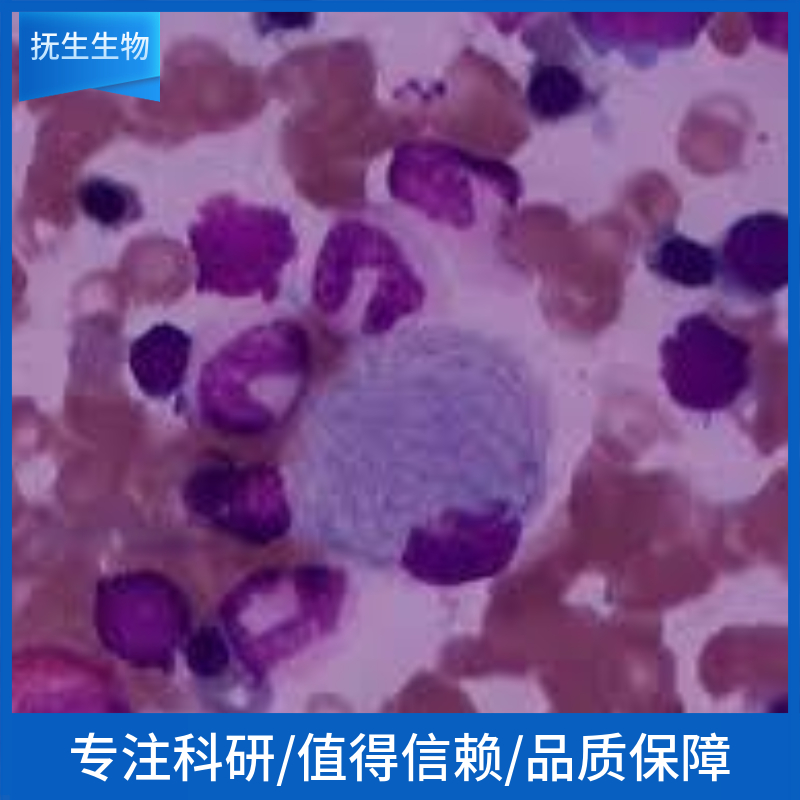 EBV-转化人淋巴细胞；KM9304