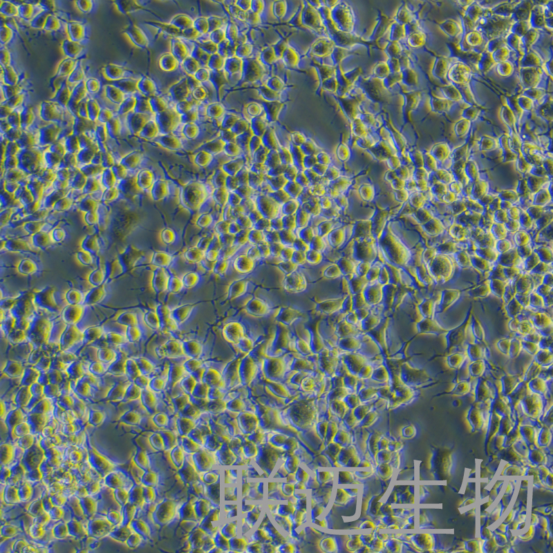 NG108-15[108CC15]细胞（小鼠神经细胞瘤与大鼠神经胶质瘤之融合细胞）LM8C0170