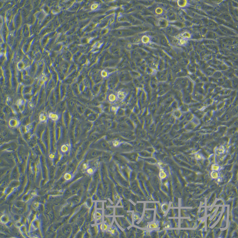 MG-63细胞（骨肉瘤细胞STR鉴定正确）LM8C0157