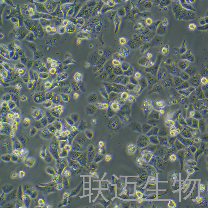 HEC-1-A细胞（子宫内膜腺癌细胞STR鉴定正确）LM8C0099