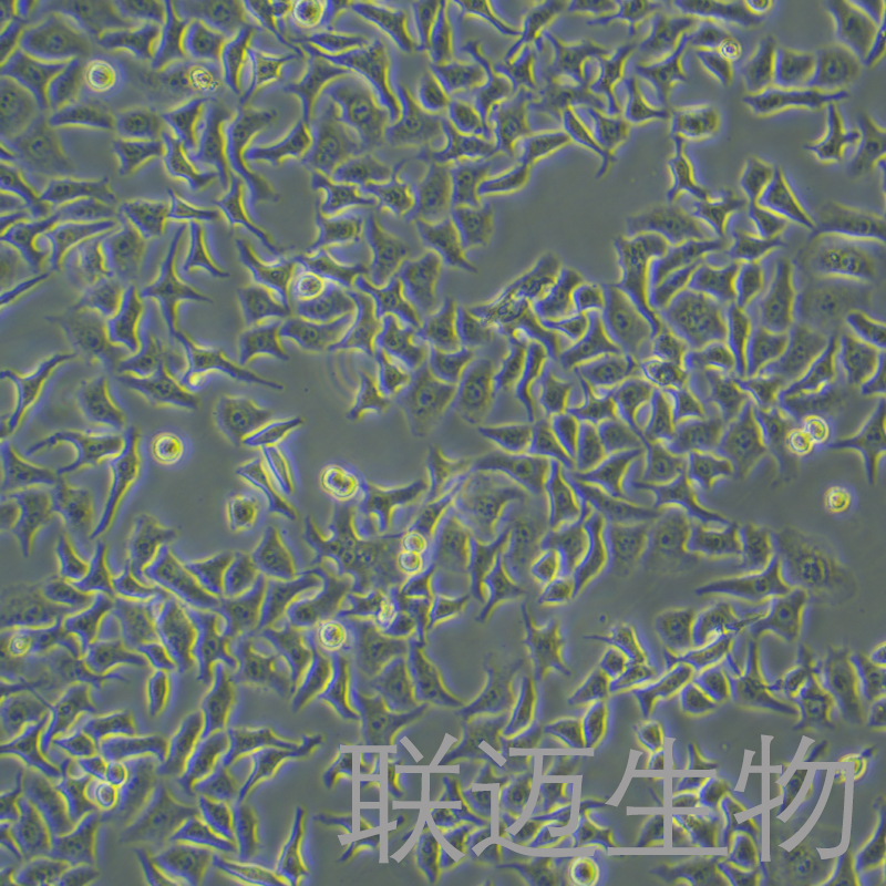 HEp-2细胞（喉表皮样癌细胞）LM8C0104