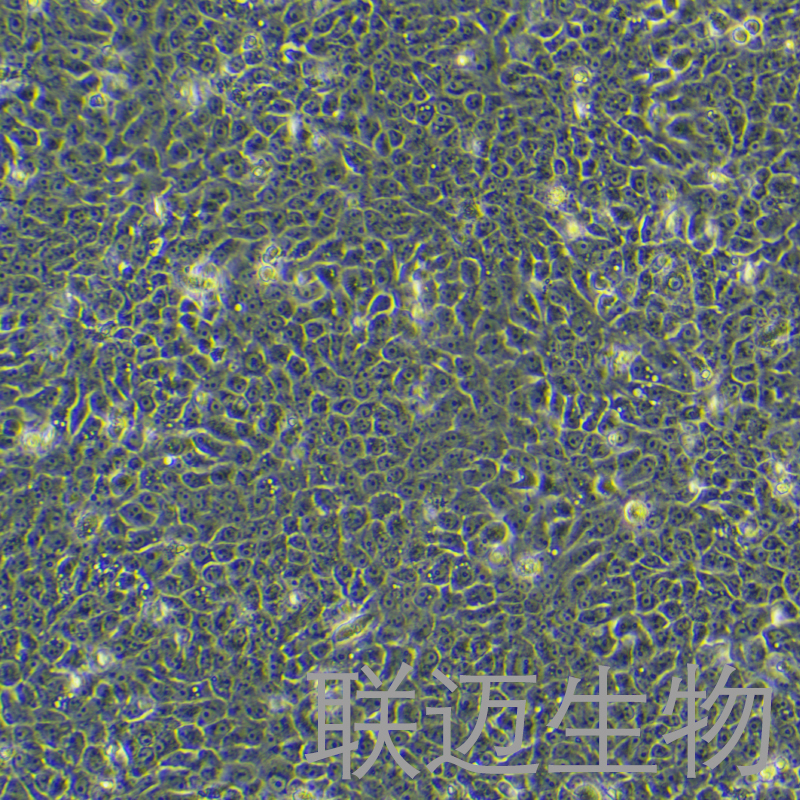 CAL27细胞（舌鳞癌细胞STR鉴定正确）LM8C0265