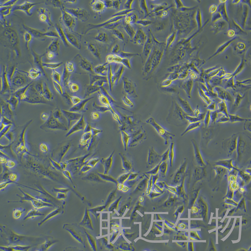 U-87MG细胞（脑星形胶质母细胞瘤细胞STR鉴定正确）LM8C0238