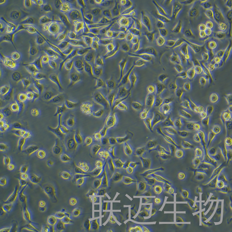 TE-1细胞（食管癌细胞STR鉴定正确）LM8C0231