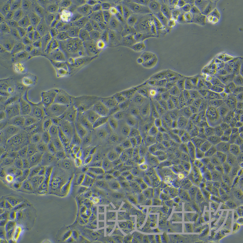 MKN-28细胞（胃癌高转移细胞）LM8C0291