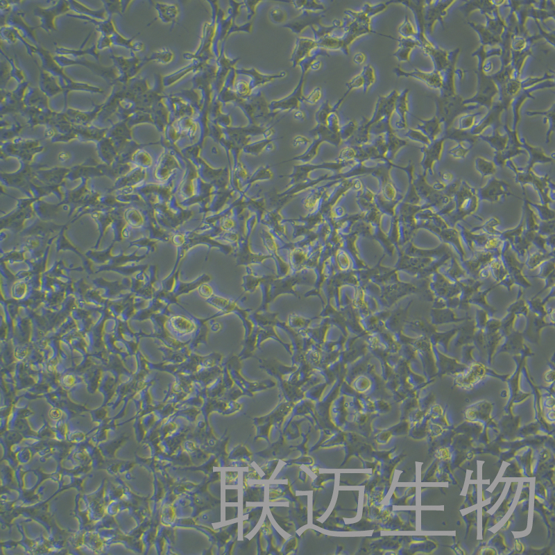 SK-N-MC细胞（神经上皮瘤细胞）LM8C0443