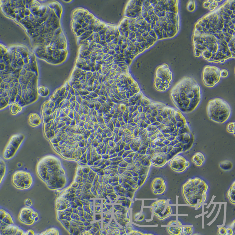 UACC-812细胞（乳腺导管瘤细胞）LM8C0461