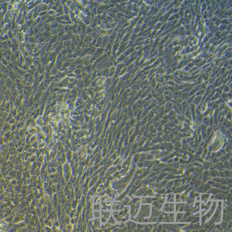 CFPAC-1细胞（胰腺癌细胞STR鉴定正确）LM8C0059