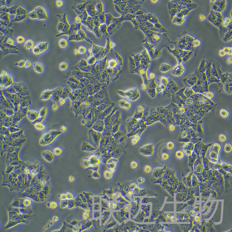 DLD-1细胞（结直肠腺癌上皮细胞STR鉴定正确）LM8C0074