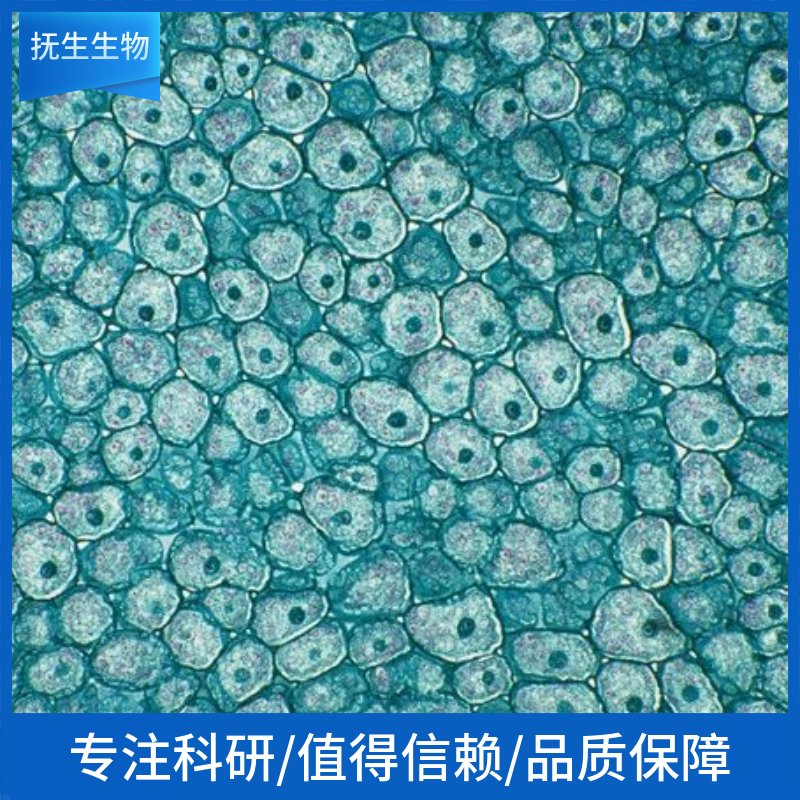 人淋巴瘤细胞+LUC+eGFP;Raji-LUC-eGFP-puro