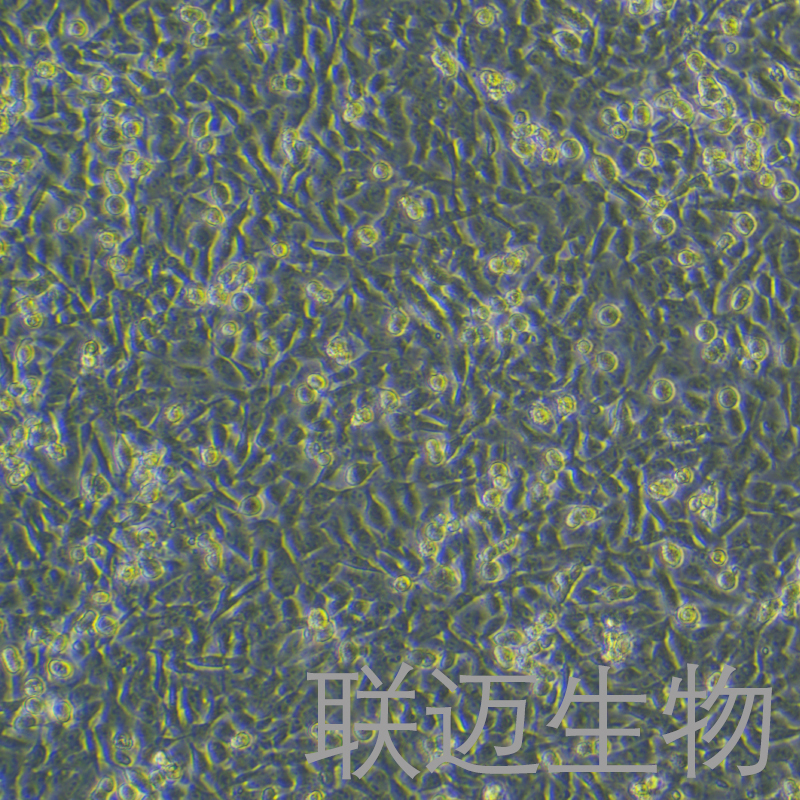 CAL-62细胞（甲状腺癌细胞未分化STR鉴定正确）LM8C0618