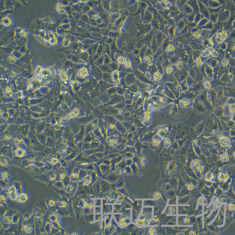 HT-1376细胞（膀胱癌细胞（STR鉴定正确））LM8C0672