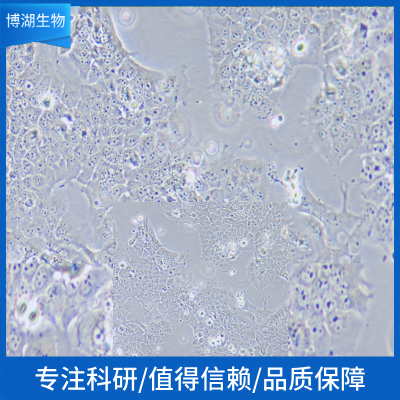 LS513人结直肠癌细胞