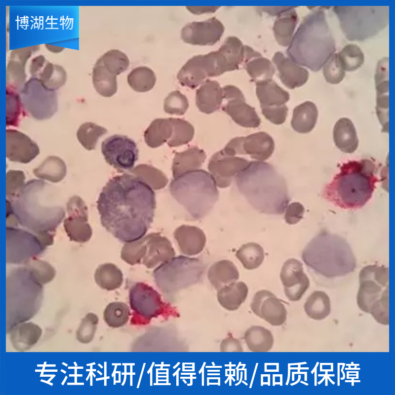 HT-1376人膀胱癌细胞