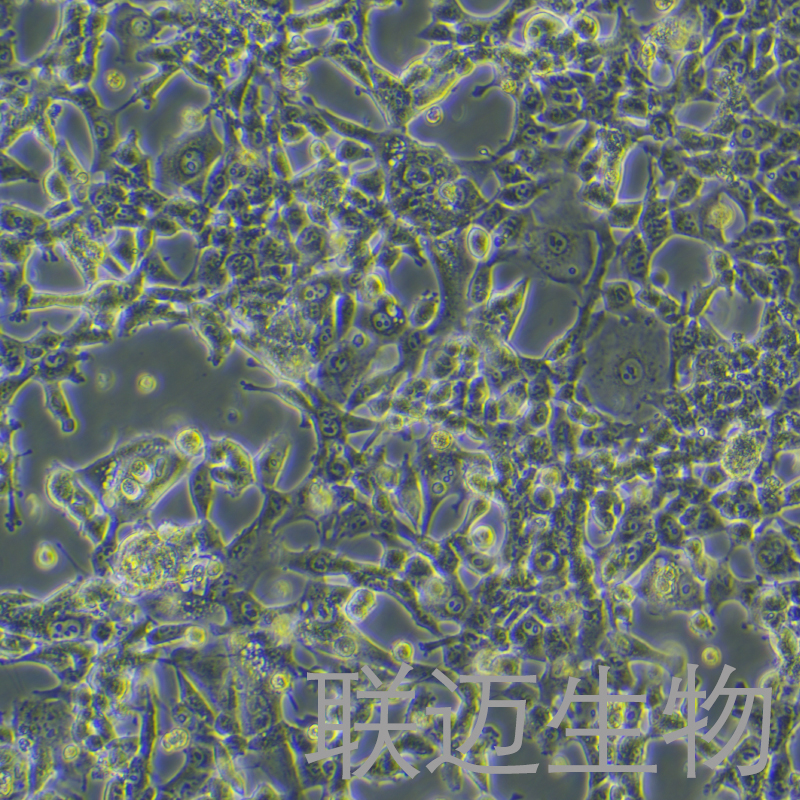 MSTO-211H细胞（肺癌细胞株STR鉴定正确）LM8C0163