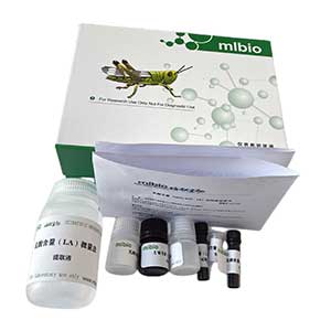 过氧化物酶(POD)测定试剂盒－测血清/48样