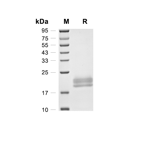 IL-6蛋白, Rat (HEK293)