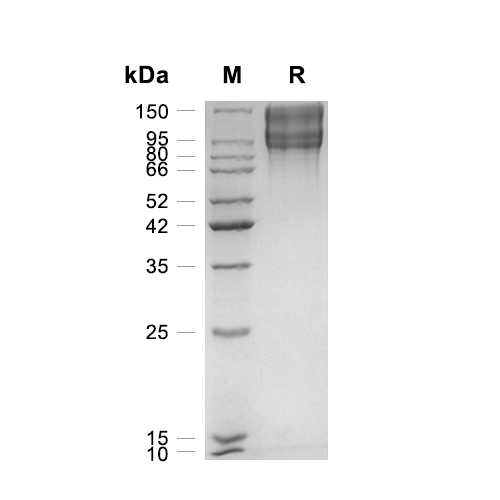 LDLR蛋白, Human (HEK293, His)