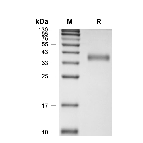 Azurocidin蛋白, Human (HEK293, His)