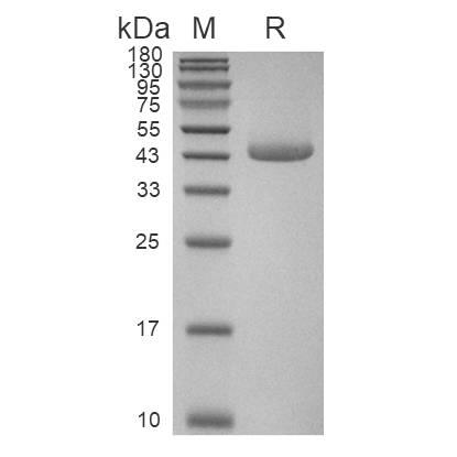 Carboxypeptidase B1/CPB1蛋白, Human (HEK293, His)