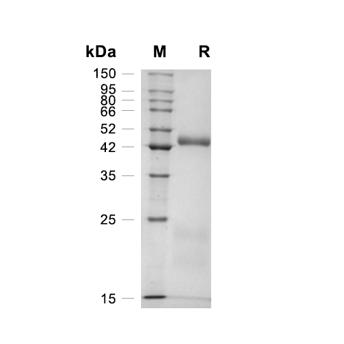 Cathepsin D蛋白, Mouse (HEK293, His)