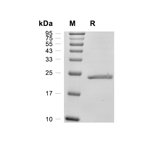 Alpha-crystallin B chain/CRYAB蛋白, Human (His)