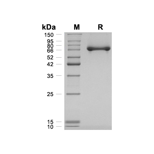 Alpha-Fetoprotein蛋白, Mouse (HEK293, His)